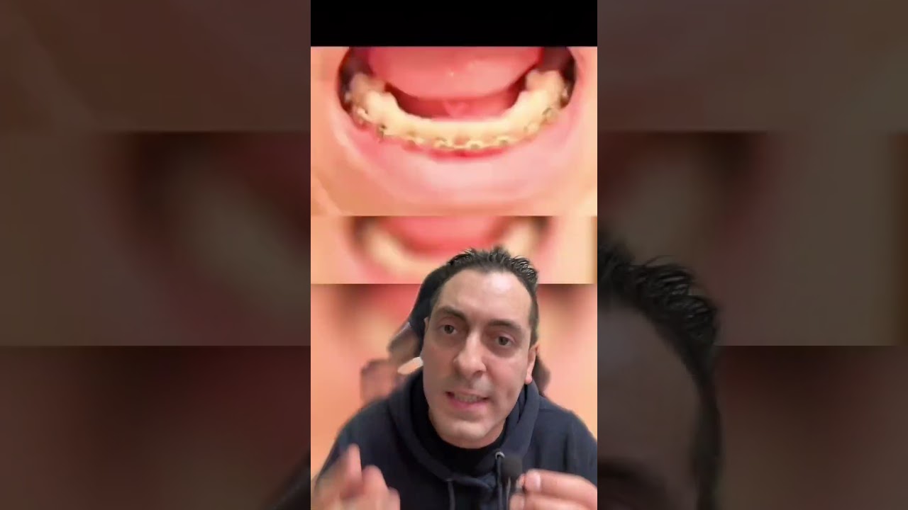 COME DAVVERO FUNZIONANO LE COSE PT.3 COSA C'E' DENTRO UNA LAVASTOVIGLIE? COME SI ESTRAGGONO I DENTI?