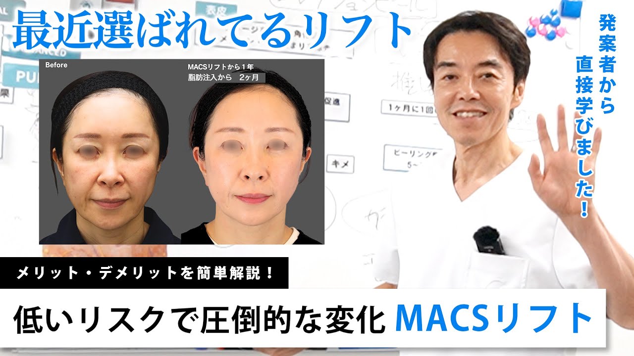 【低いリスクで高効果】MACSリフトが最近選ばれている理由 / メリット・デメリットを解説👨&zwj;⚕️💡【美容整形】