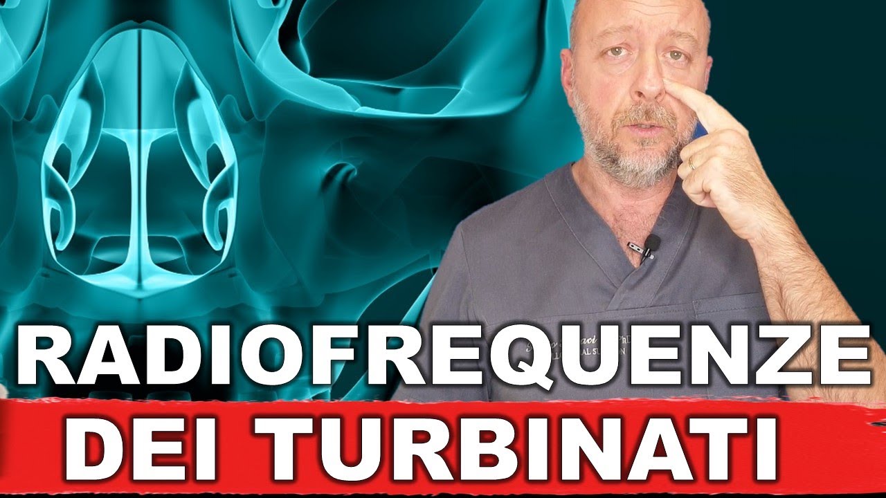 Radiofrequenza turbinati