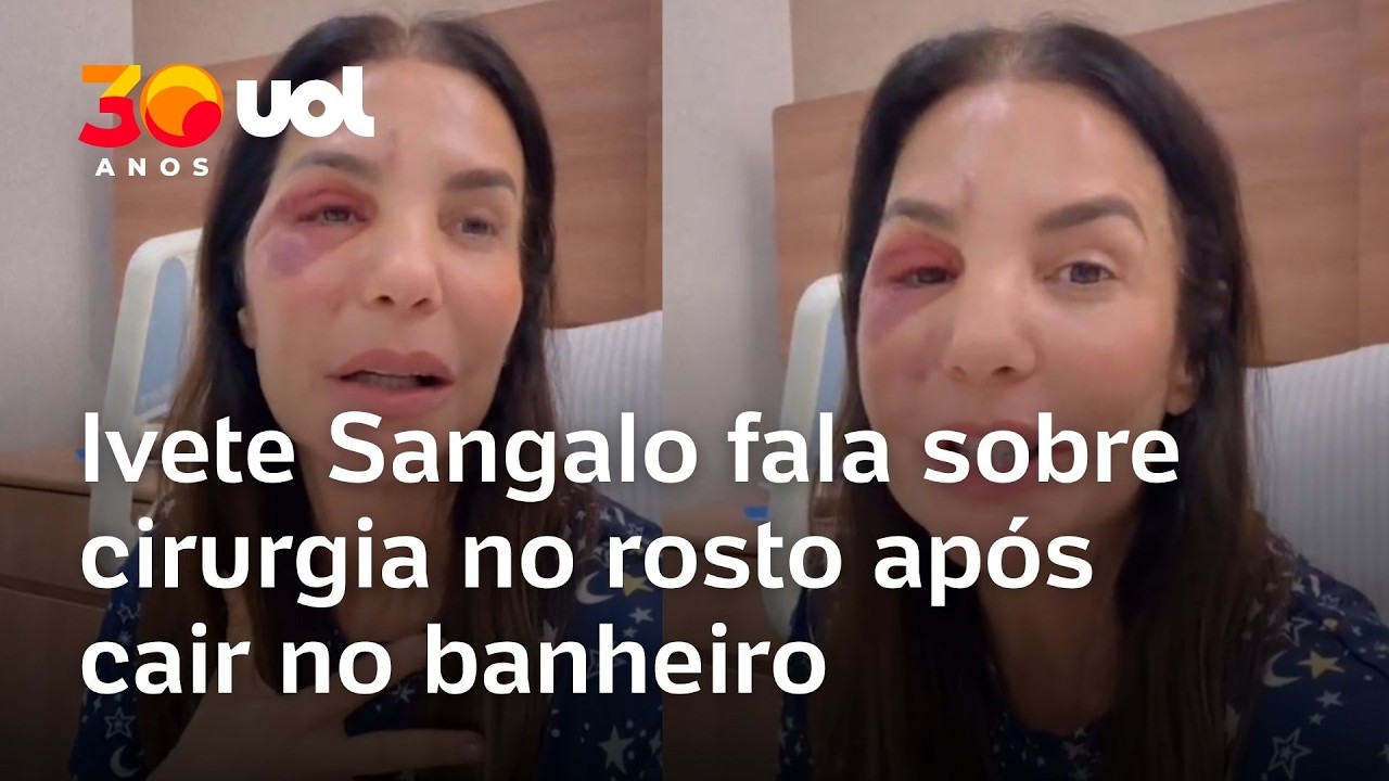 Ivete Sangalo fala de cirurgia no rosto após cair no banheiro