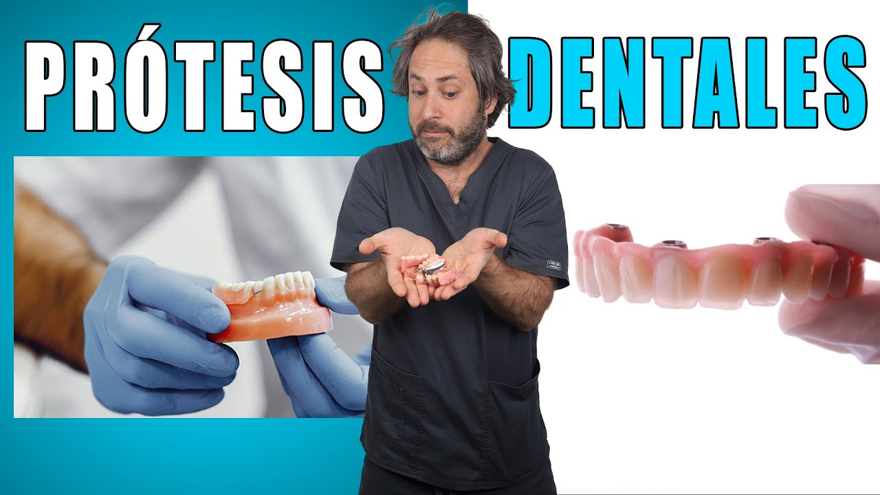 SI me quedo 𝐒𝐈𝐍 𝐃𝐈𝐄𝐍𝐓𝐄𝐒 ¿que TIPOS  de prótesis dentales FIJAS y REMOVIBLES existen?  ✅