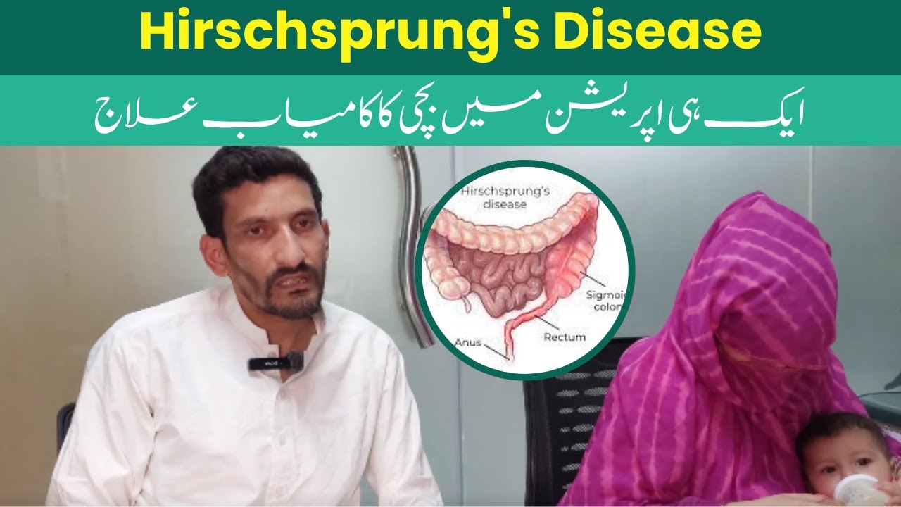 Father's Review After Successful Single-Stage Surgery for Hirschsprung Disease