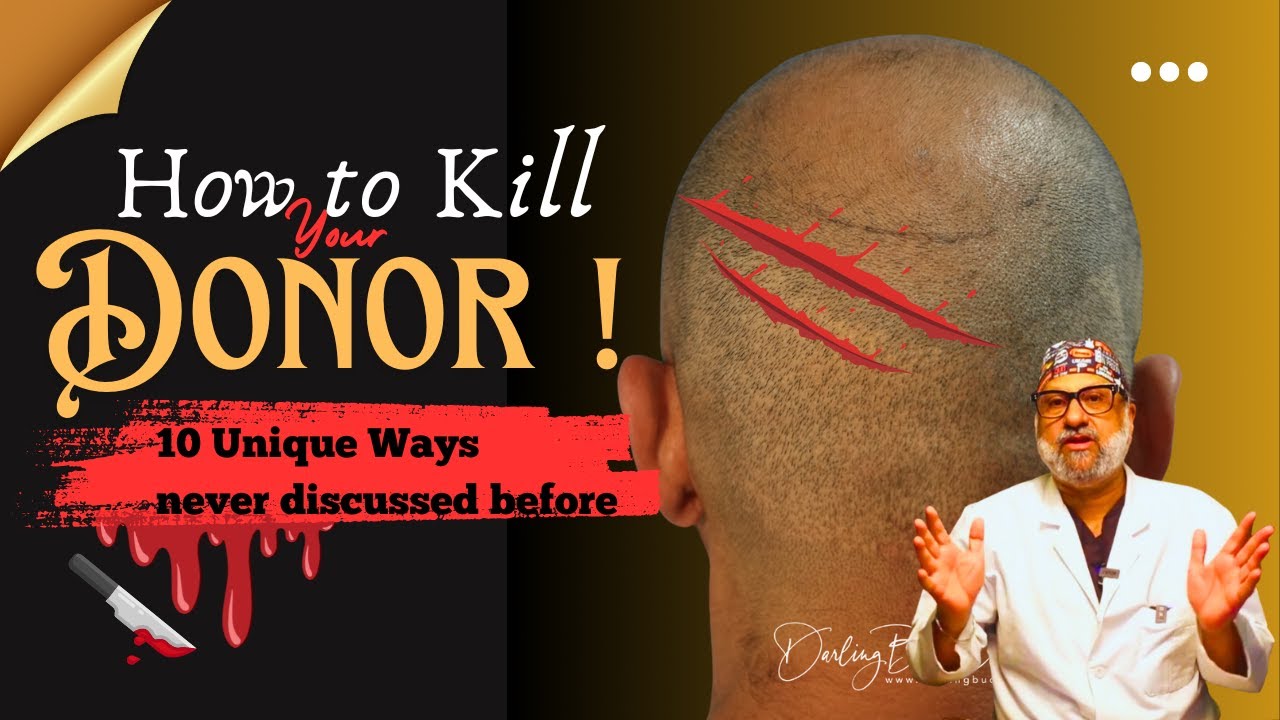 Hair Transplant in India without Side-Effects