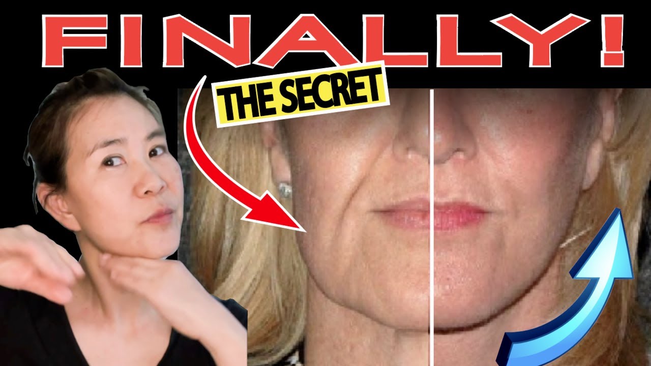🤫 The Secret to Making Smile Lines Disappear 🥳 — No Surgery❗️