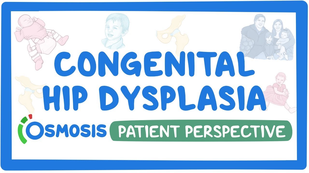 Patient Perspective: Congenital hip dysplasia