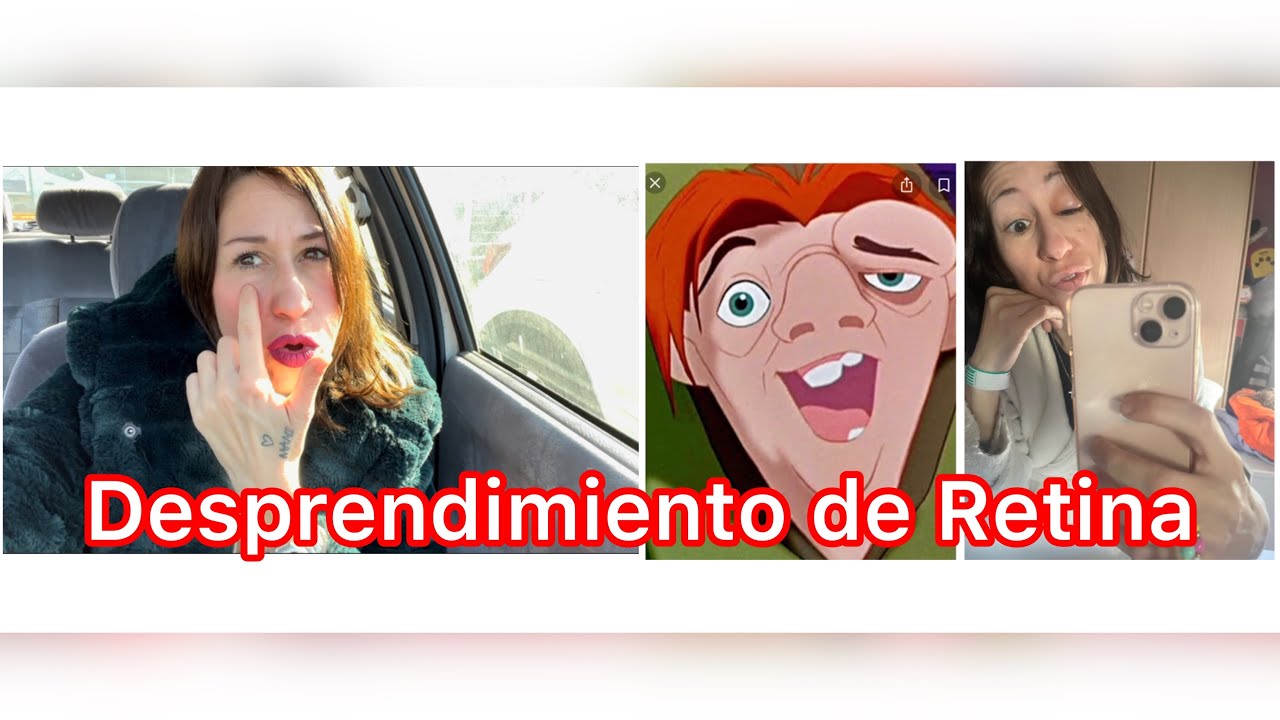 Operación desprendimiento de retina. Cuento mi experiencia. ☺️👁️