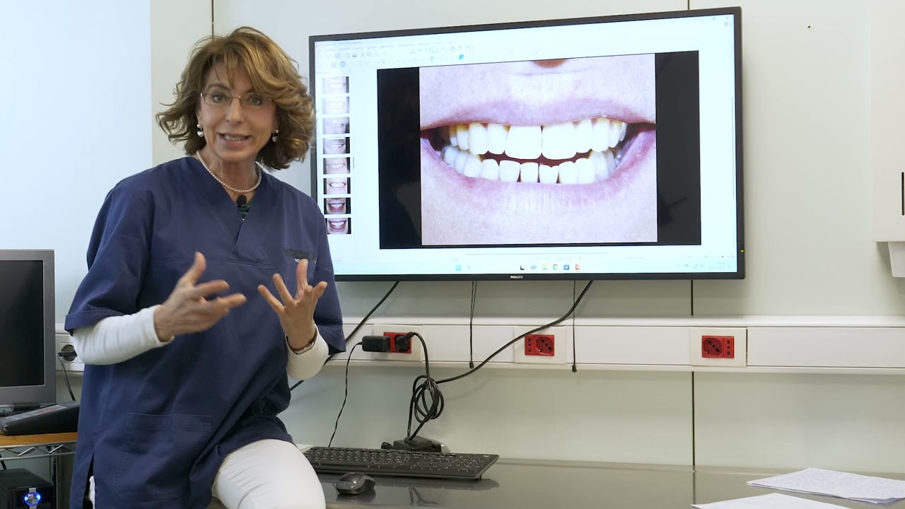 Gli spazi fra i denti: come risolvere il problema