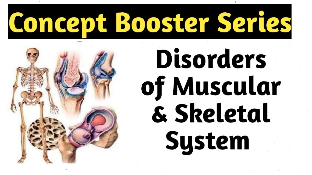 Disorders of Muscular & Skeletal System | Movement and Locomotion Class 11 | NEET Biology |