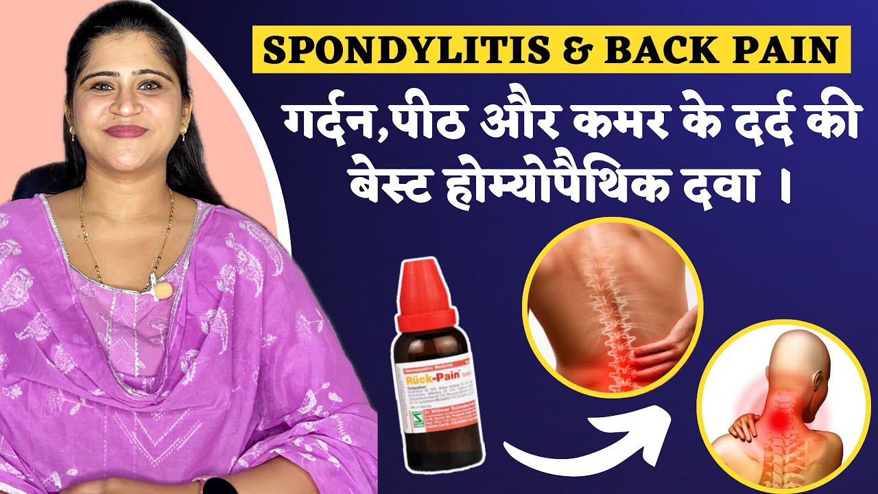 Spondylitis and Back Pain : Best Homeopathic Medicine | गर्दन पीठ और कमर के दर्द का इलाज |