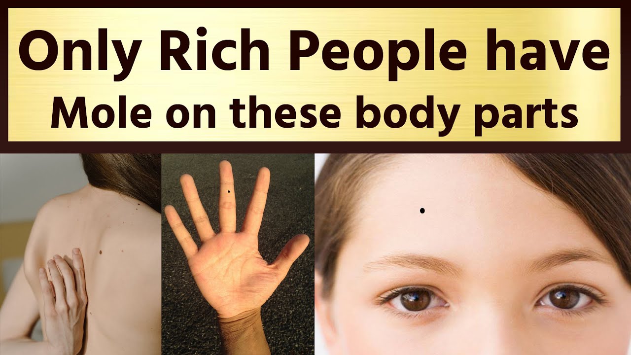 Only Rich People Have Mole on These Body Parts | Samudrik shastra