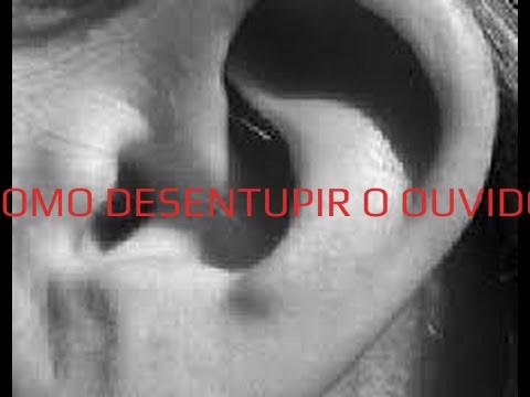 COMO DESENTUPIR O OUVIDO, RECEITA CASEIRA SIMPLES [F&Aacute;CIL E R&Aacute;PIDA]
