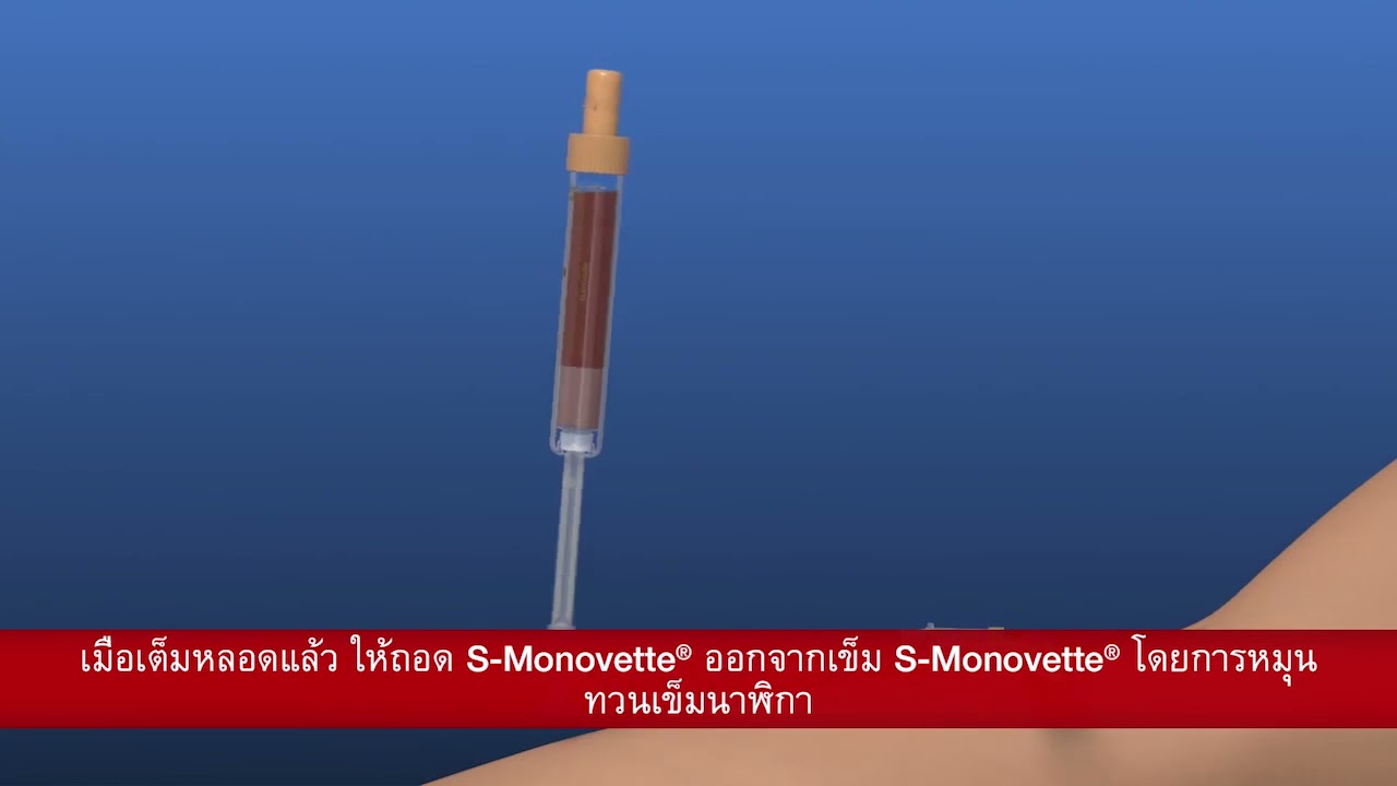 การเจาะเก็บเลือดด้วย S Monovette