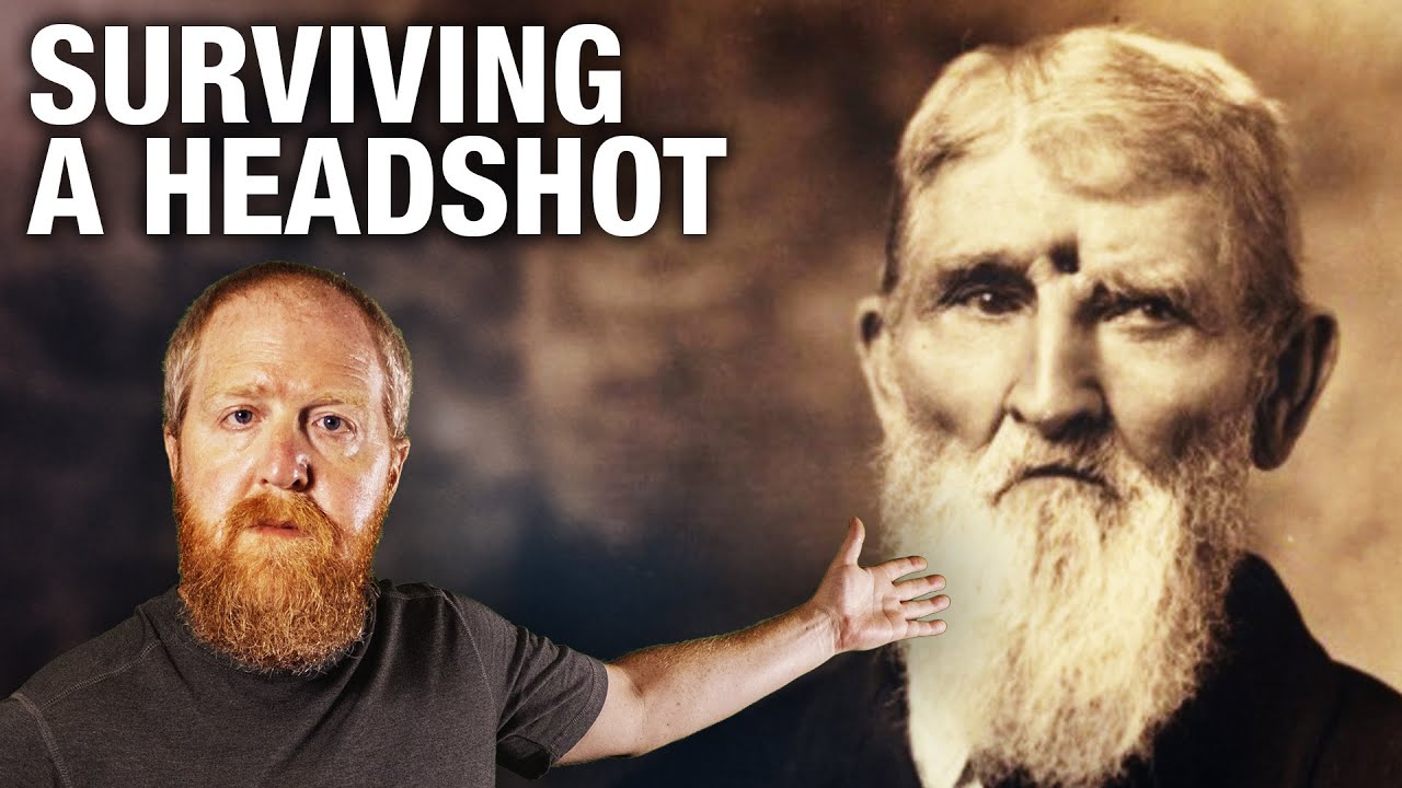 Civil War Soldier Shot in the Head... and Lived!