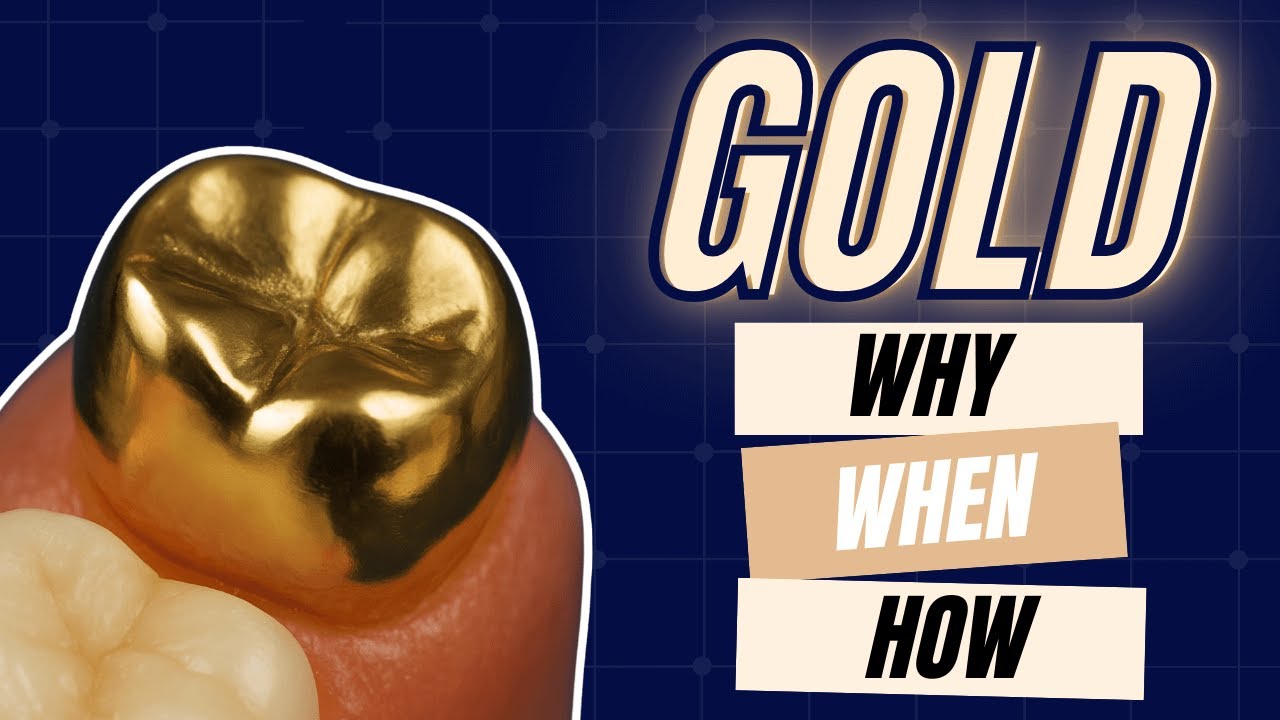Gold Restorations: Why, When, and How with Lane Ochi @DentalGeek967  - PDP236