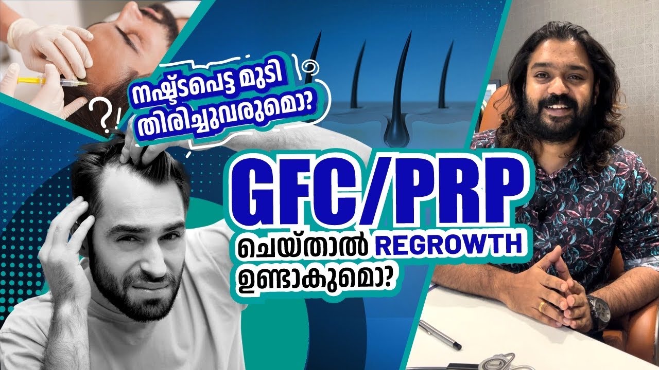 PRP / GFC ചെയ്താൽ പോയ മുടി തിരിച്ചു വരുമോ ? Regrowth ഉണ്ടാവുമോ ?🙆‍♂️