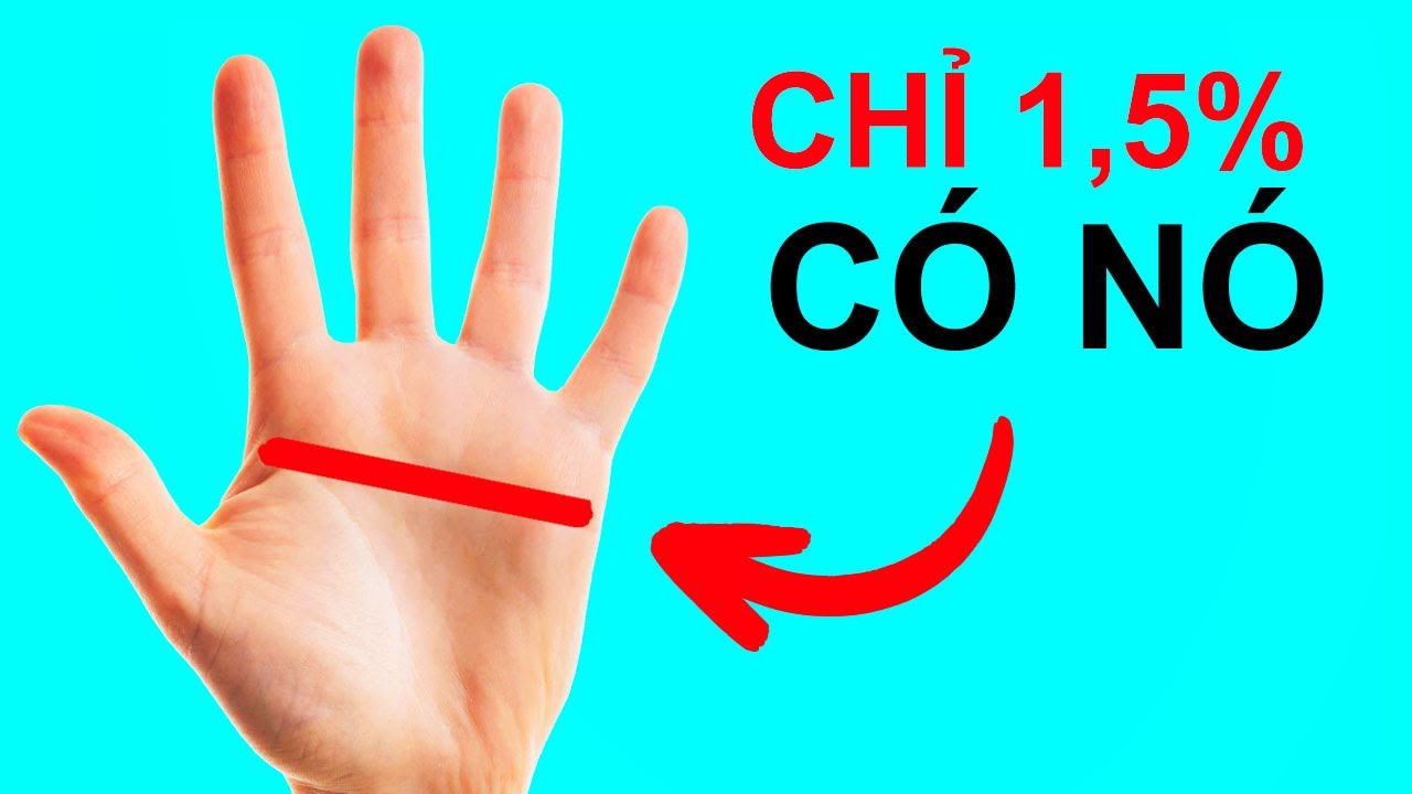 Bạn Là Độc Nhất Nếu Có Đặc Điểm Cơ Thể Hiếm Gặp Đó