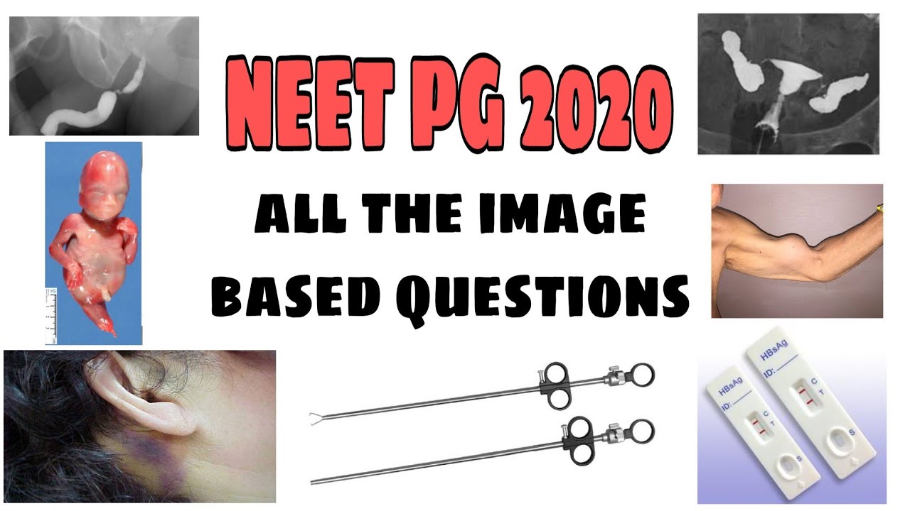 NEET PG 2020 - All the image based questions asked in the exam