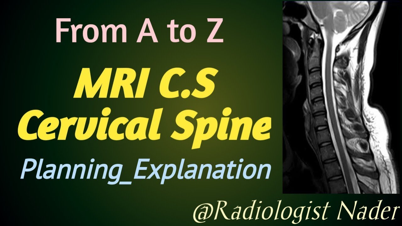 رنين مغناطيسي علي الفقرات العنقية. تخطيط مع الشرح MRI Cervical spine( C.S ).Planning and explanation