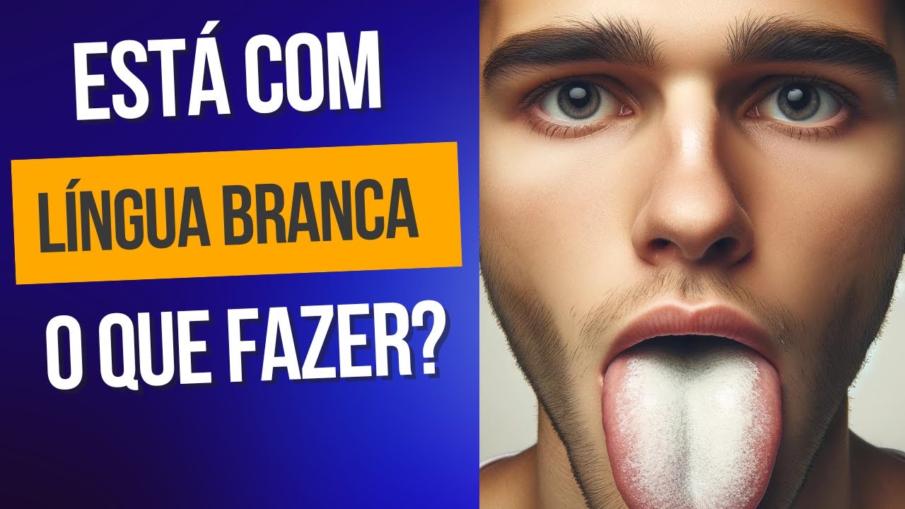 7 questões sobre língua branca e saburra lingual