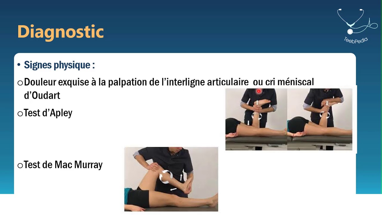 Lésions méniscales du genou - Docteur Ould Chakmakdji