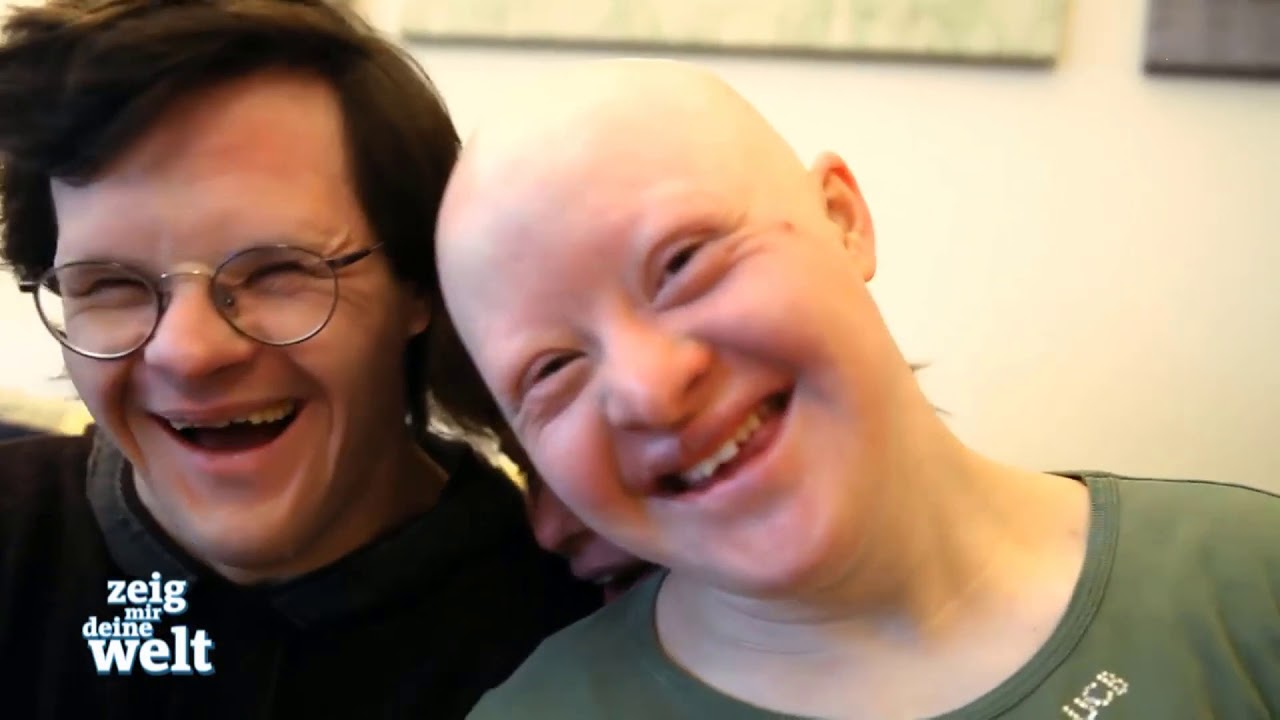 Best of Downsyndrom