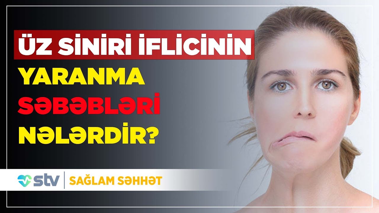 Üz siniri iflici yaranma səbəbləri