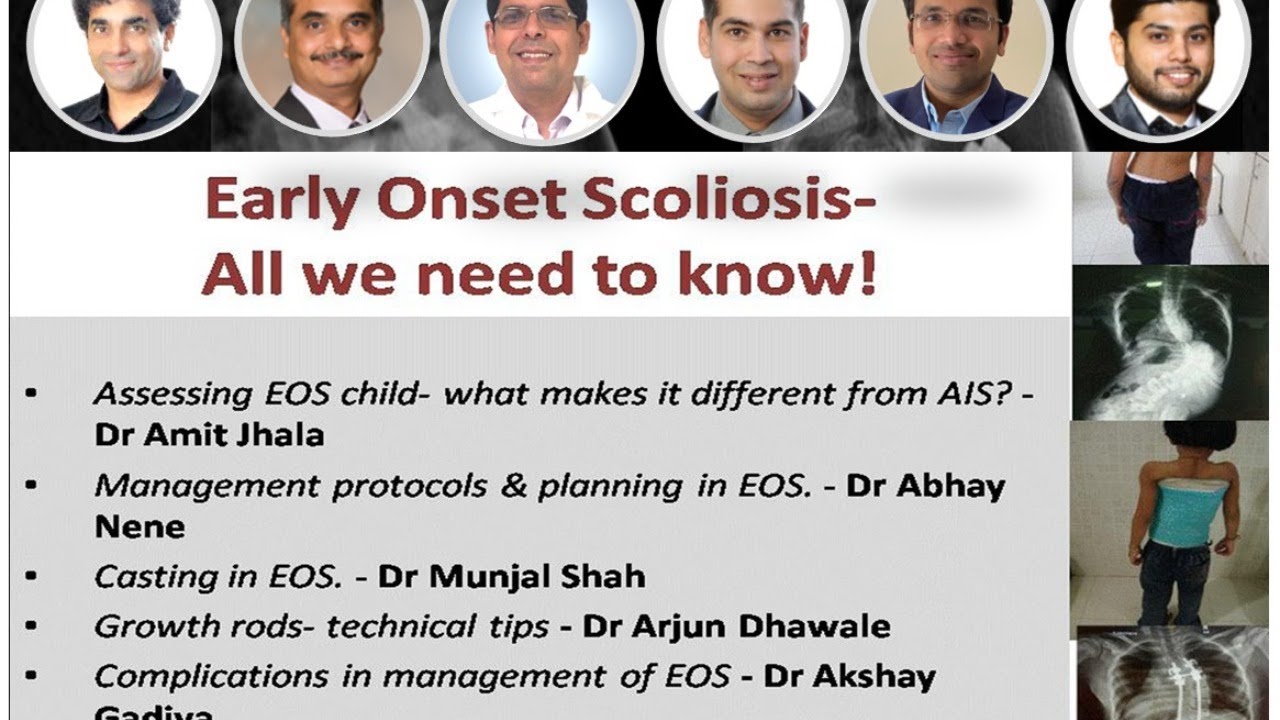 🔰 The We Are Spine ChatShow: Topic: _Early Onset Scoliosis - All we need to know