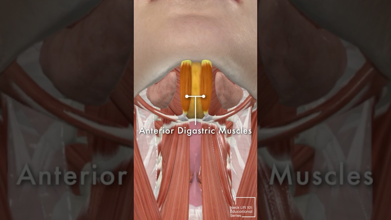 Neck Lift 101: The 4 Layers of the Neck Explained | Part 2 #NeckLiftSurgery