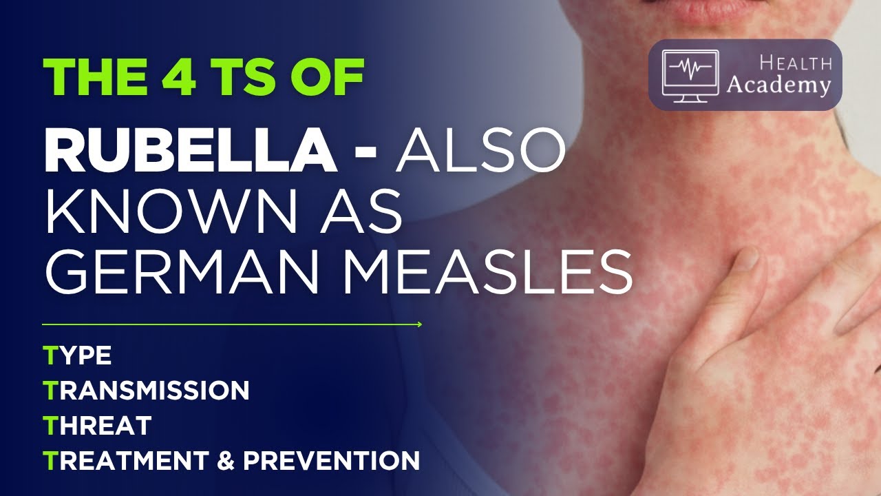 The 4T's of Rubella (Also Known as German Measles)