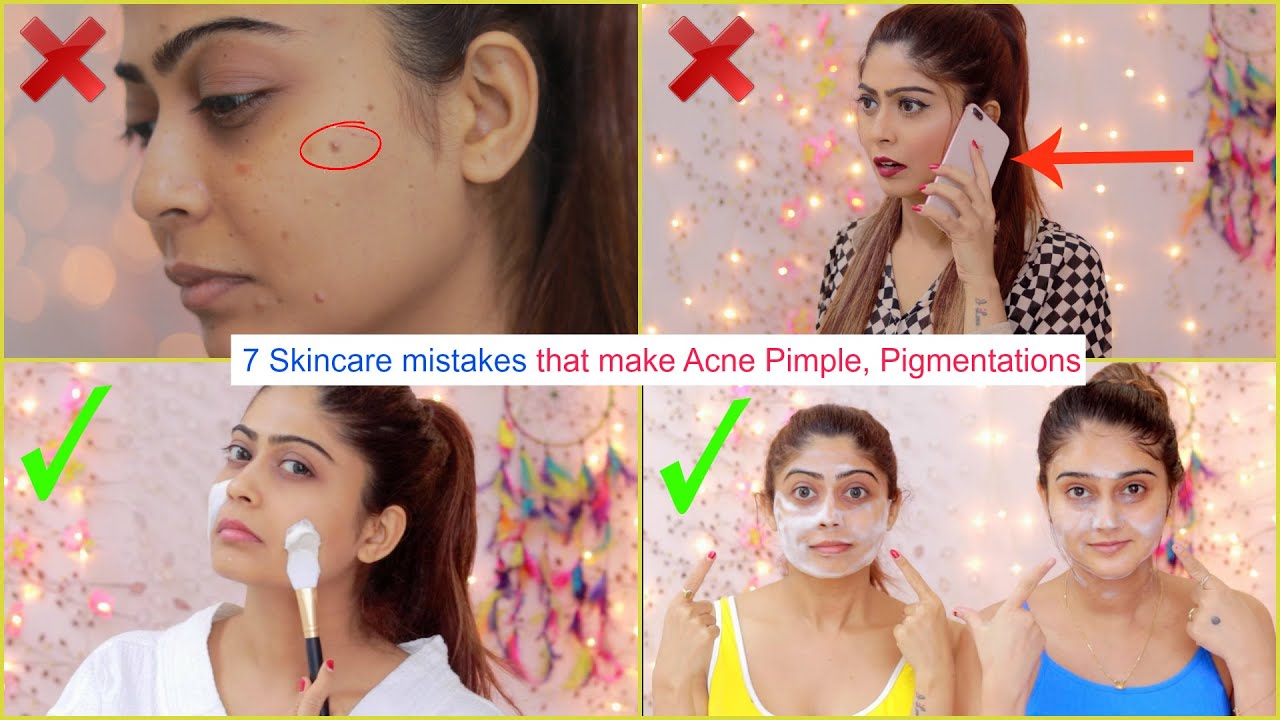 7 SKINCARE MISTAKES That Can Make ACNE & Large PORES Worse!