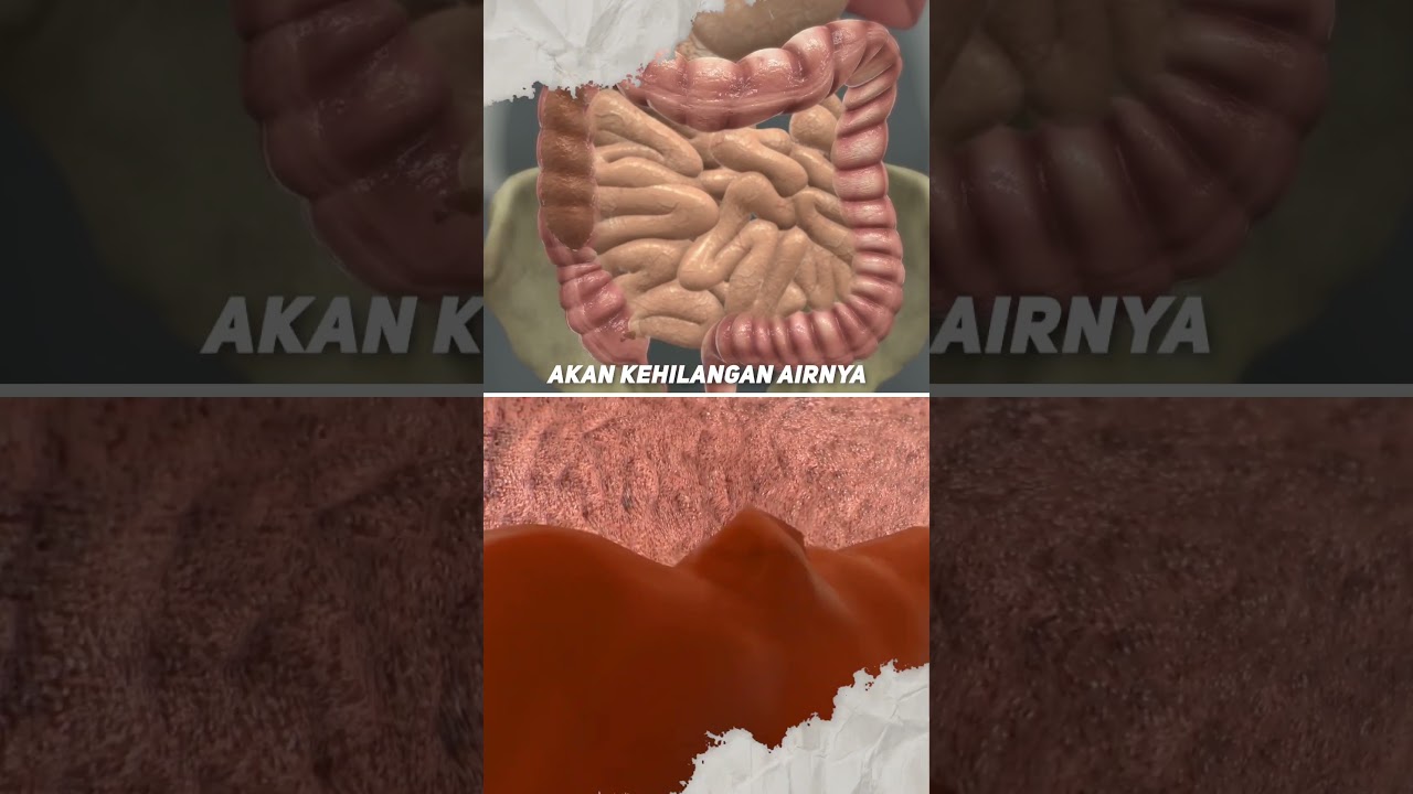 Inilah yang Terjadi Pada Tubuh Kita Saat Sembelit Menyerang!!! 🥵🤯