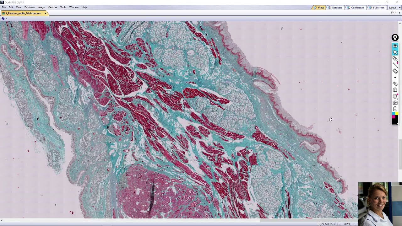 soft palate (palatum molle)
