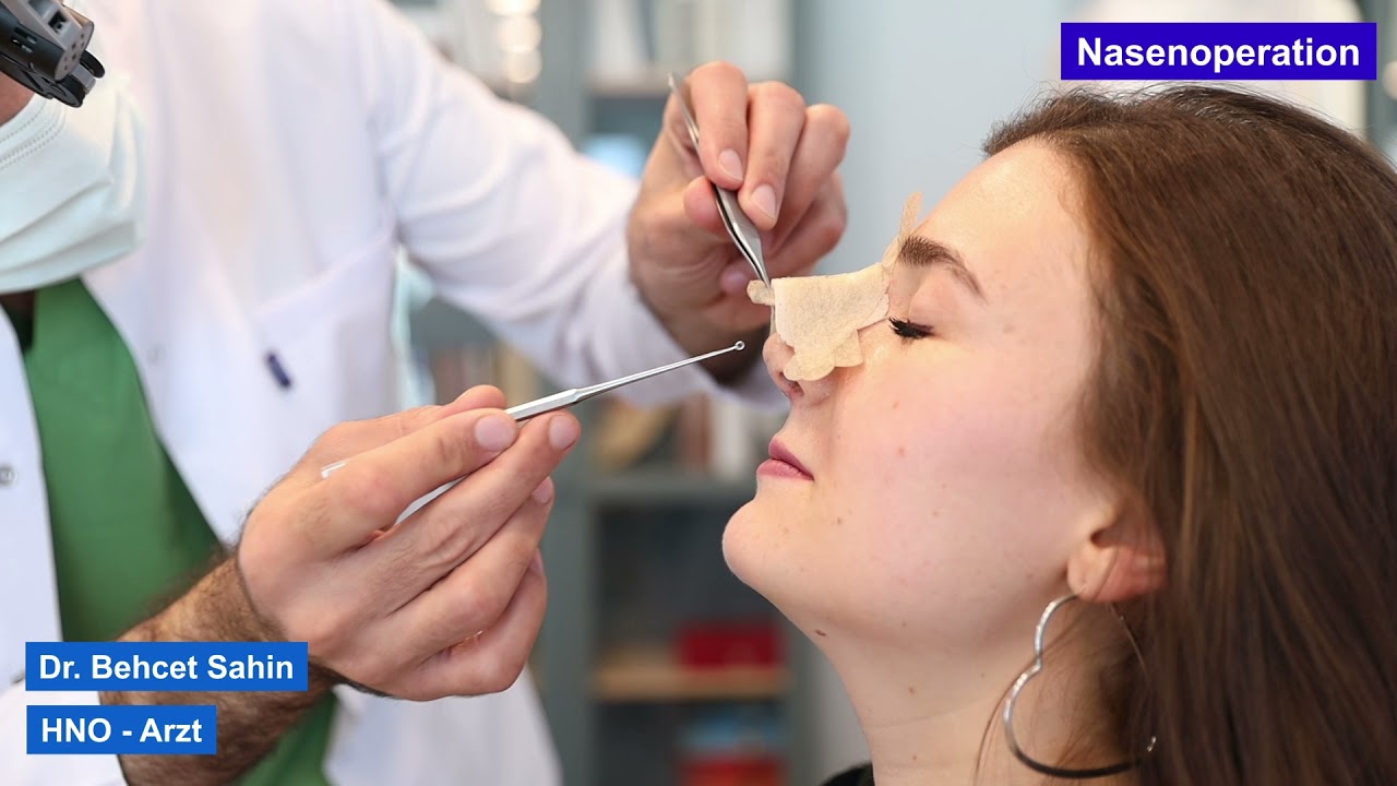 Die Nasenoperationsphase unserer Patientin aus Deutschland - Dezember 2021 - Dr. Behcet Sahin