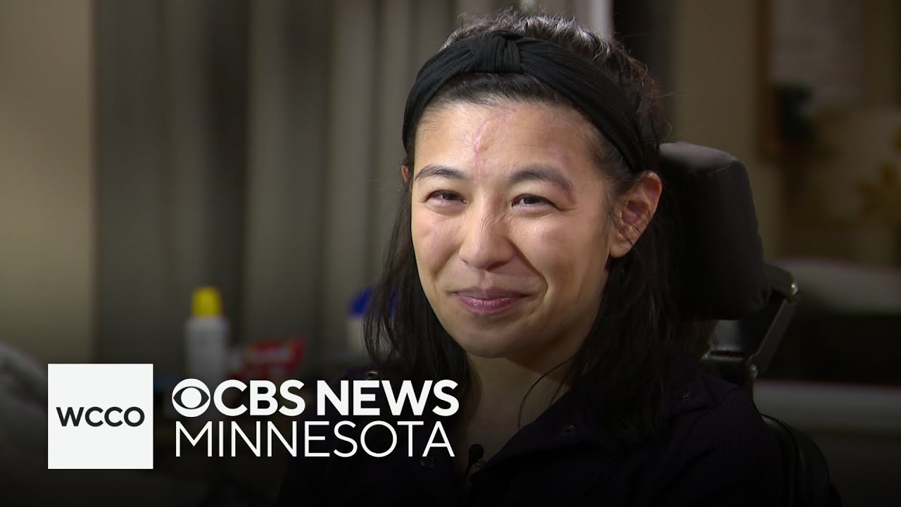 Doctor paralyzed in hiking accident determined to get back to work