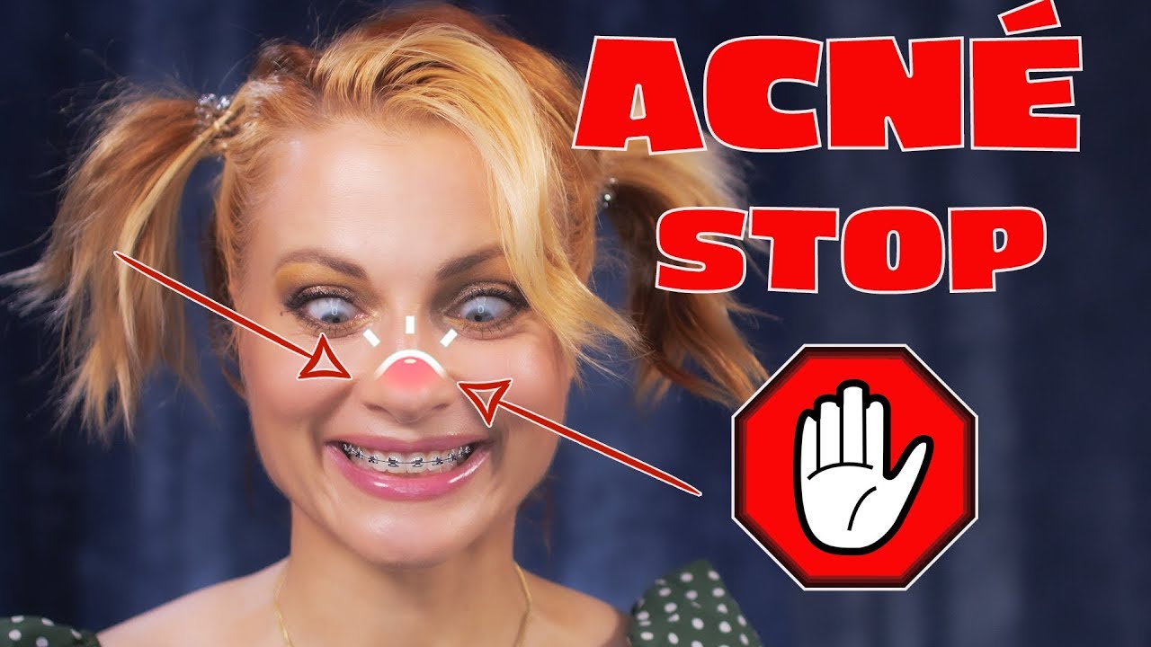 ROUTINE ANTI-ACNÉ