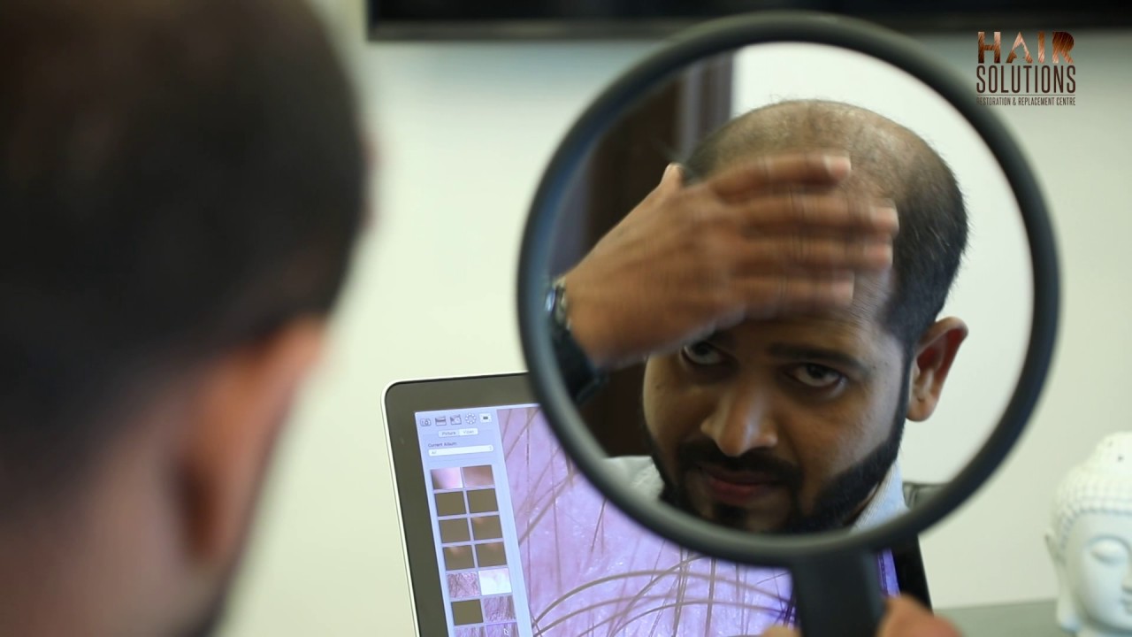 Hair Solutions Non Surgical Hair Replacement Procedure