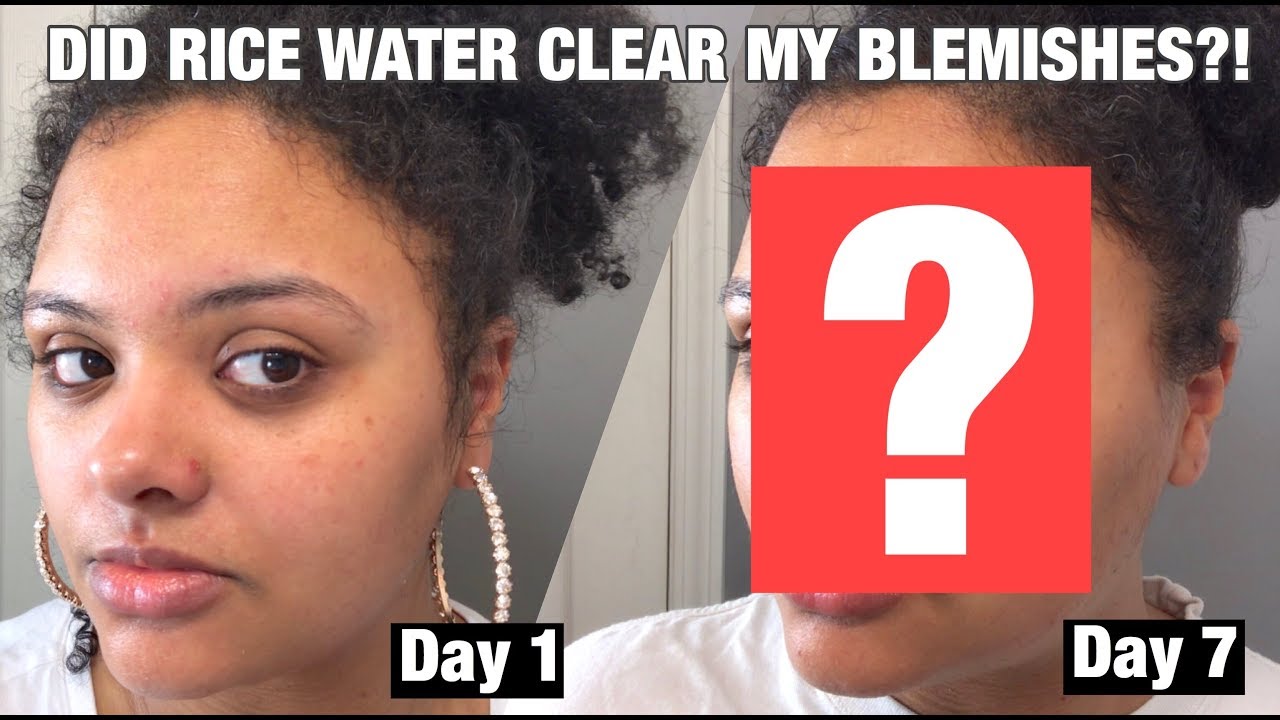 I USED RICE WATER ON MY FACE FOR A WEEK...