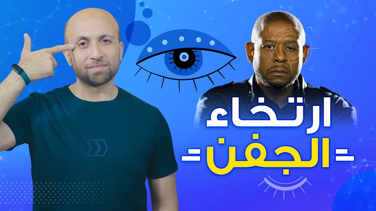 #ارتخاء_الجفن .. أسبابه ومتى موعد العملية ؟ وإمتى يكون خطر على الحياة ؟؟🙄| #The_Eye_Doctor