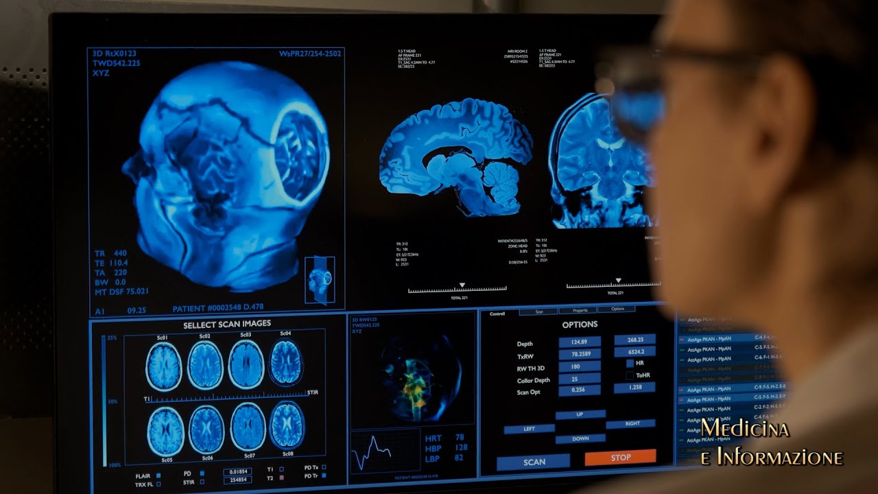 SCLEROSI MULTIPLA: nuove conoscenze, diagnosi, le terapie più efficaci per bloccare la progressione