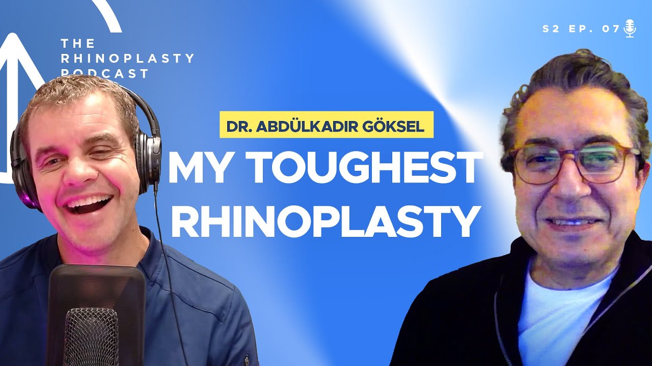 My toughest rhinoplasty with Dr. Abdülkadir Göksel