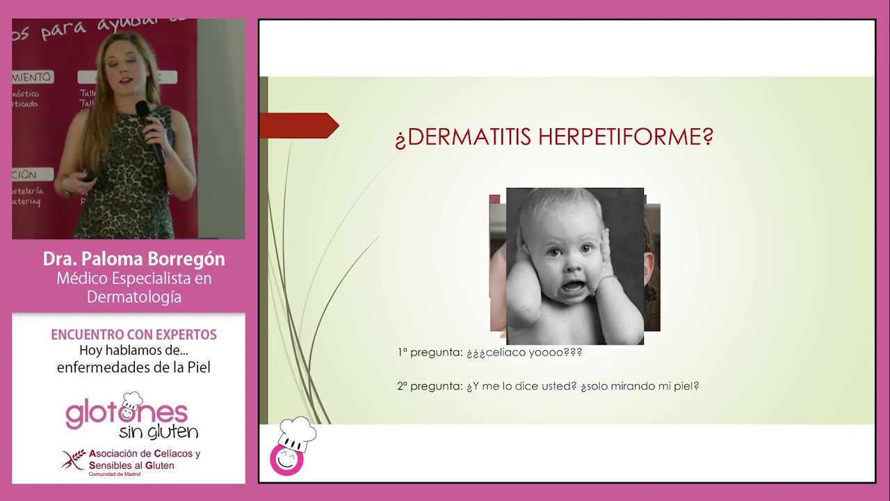 Dermatitis Herpetiforme. Conferencia de la Dra. Paloma Borreg&oacute;n