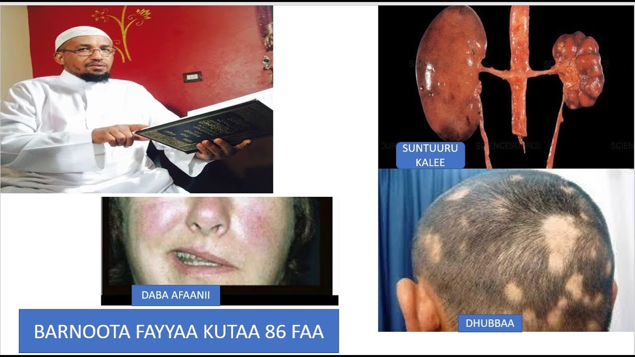 BARNOOTA FAYYAA KUTAA 86  بندق