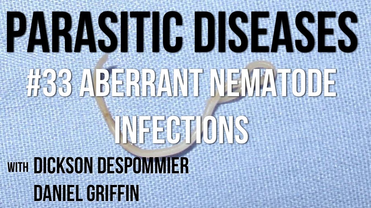 Parasitic Diseases Lectures #33: Aberrant Nematode Infections