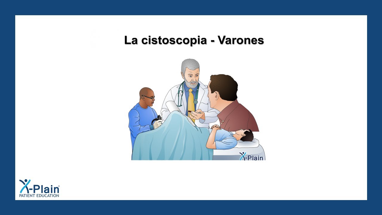 La cistoscopia - Varones