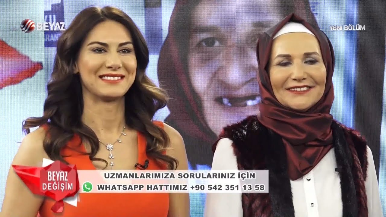 Şahinde hanım'ın yeni dişleri sizce nasıl olmuş?