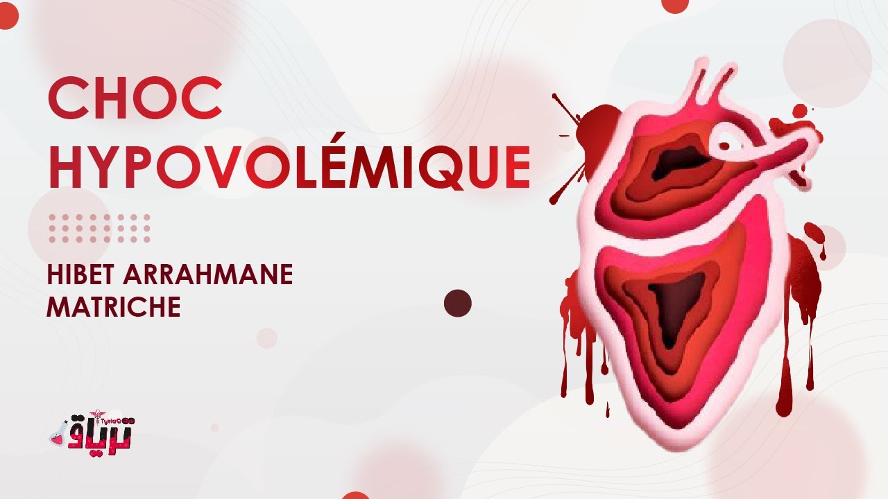 #Physiopathologie - CHOC HYPOVOLÉMIQUE par HIBET ERRAHMEN MATRICHE