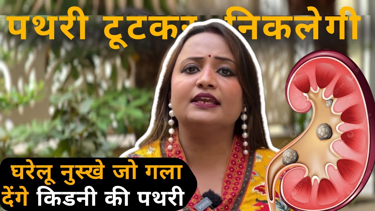 Kidney Stone Remedies बार बार बन जाती है पथरी ? इन उपायो से पेशाब के साथ निकलेगा Stone |Jeevan Kosh​