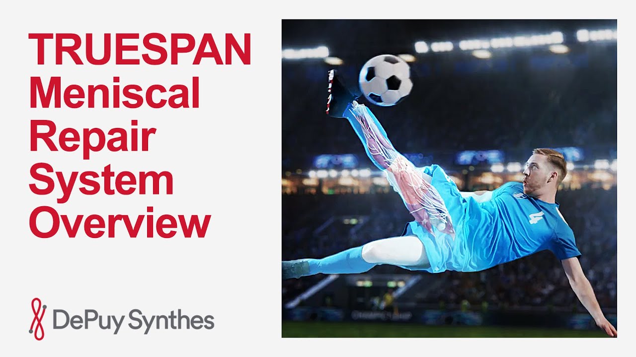 TRUESPAN Meniscal Repair System: Features, Benefits & Surgeon Insights | DePuy Synthes