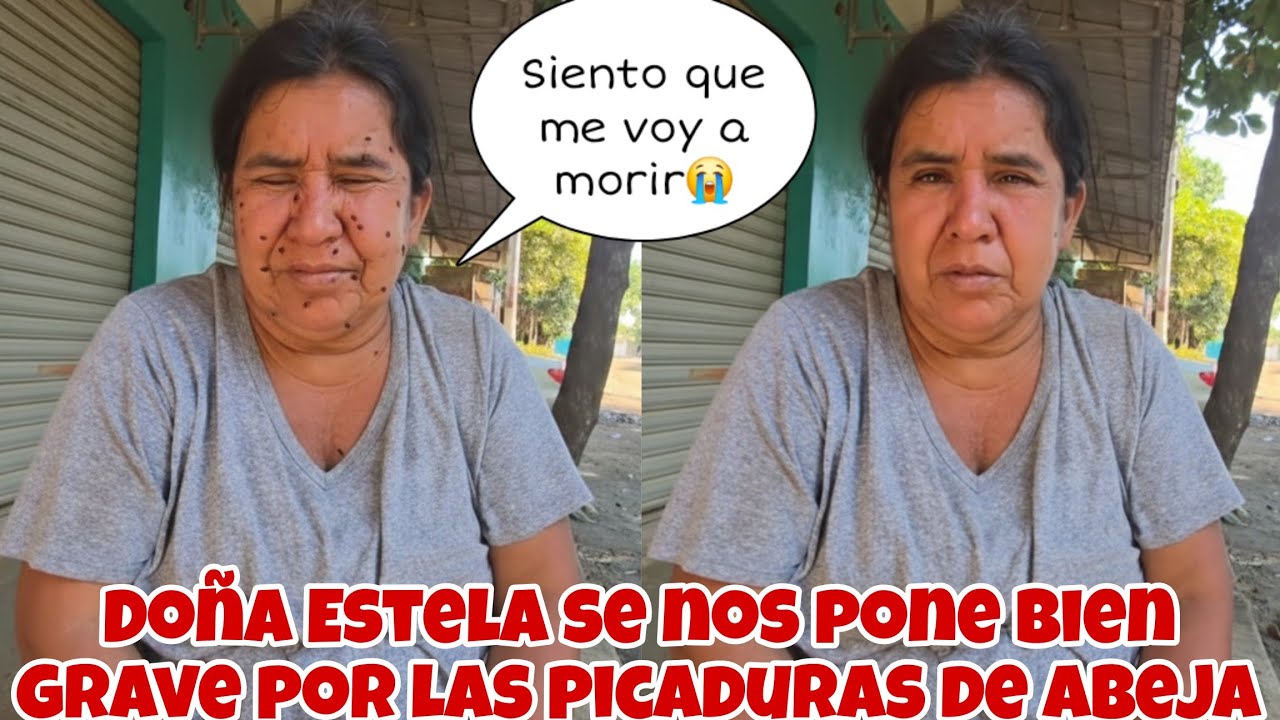 🚨URGENTE Tendremos que SACAR A Doña ESTELA DE EMERGENCIA😭Se Nos Puso Bien Grave por las picaduras