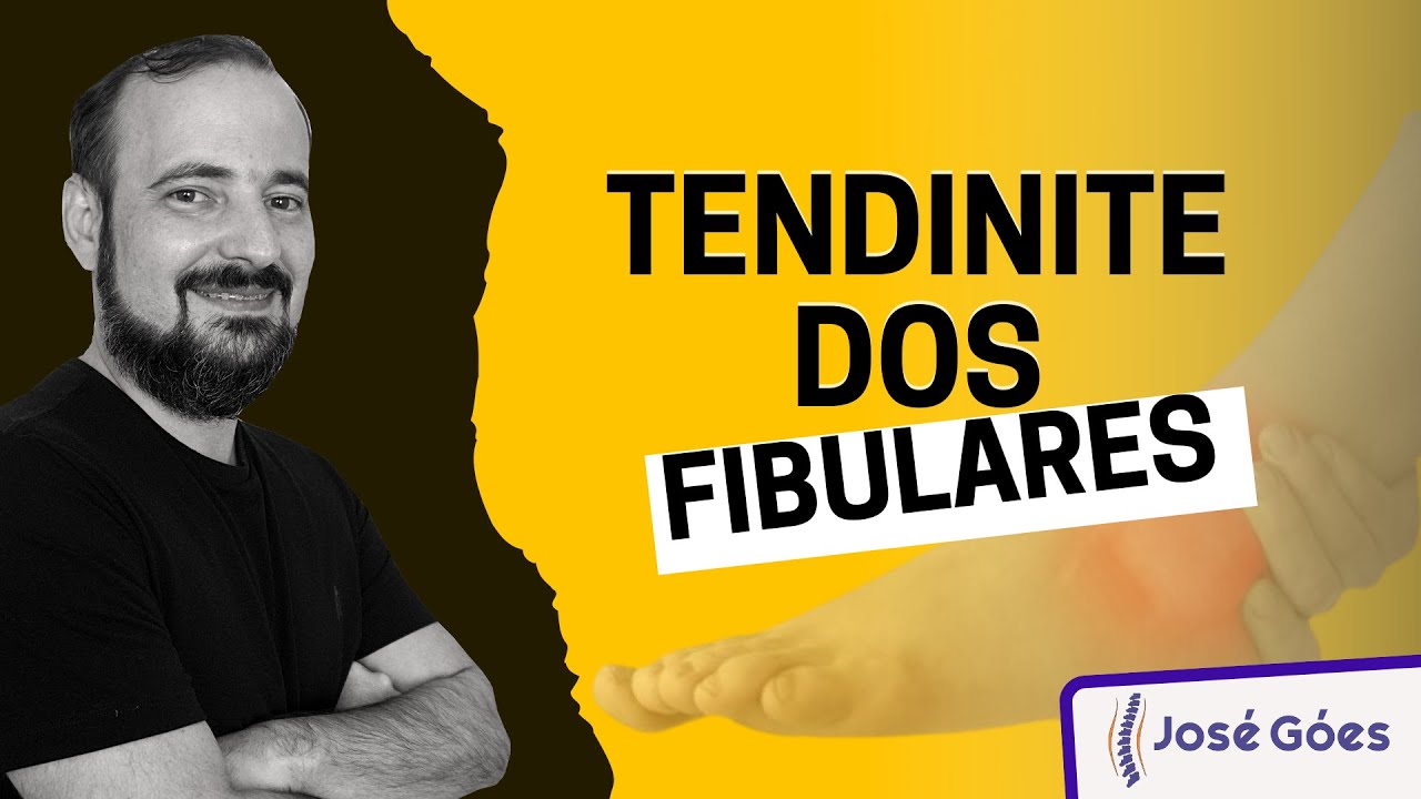 Tendinite dos fibulares | José Góes